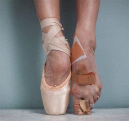 Is Ballet Bad for Your Feet? A Dance Perspective on the Matter